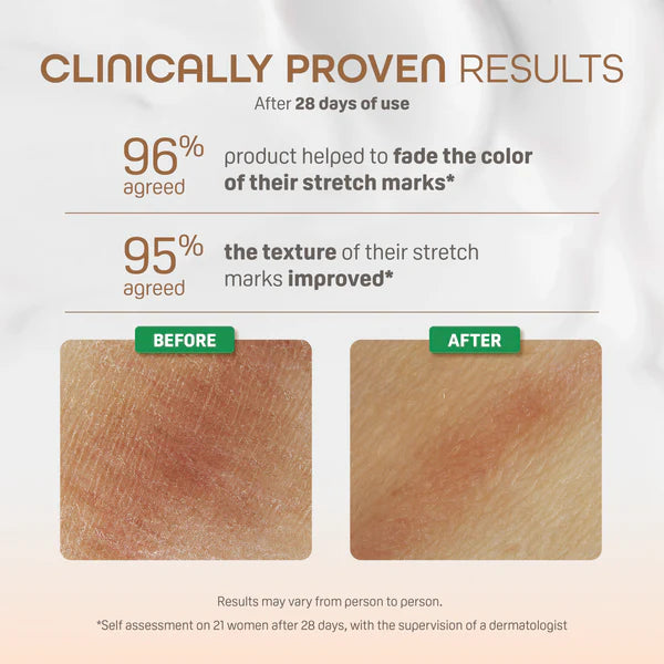 Zubaida's Pigeon Natural Botanical Maternity Stretch Marks Serum 40ml - I79894 - Zubaidas Official™