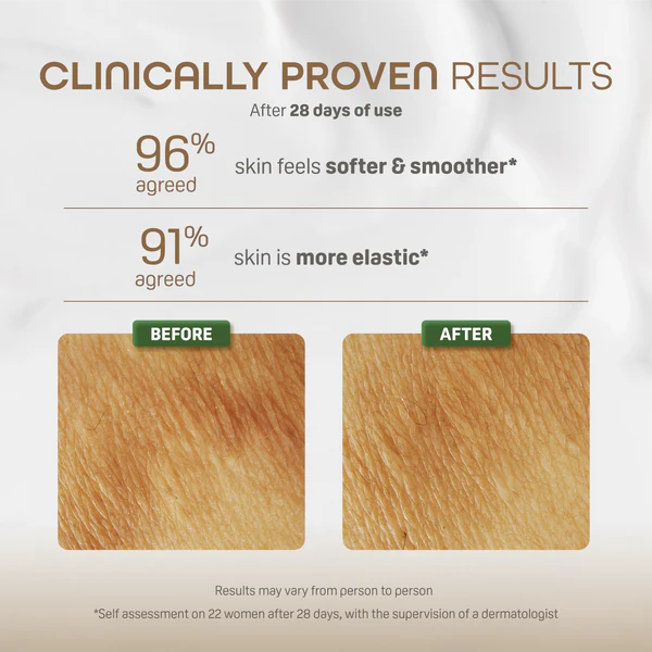 Maternity Stretch Marks Cream Pigeon 150ml I79893 at Zubaidas